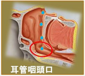 点鼻療法のイメージイラスト